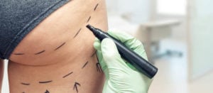 APS Website Ανόρθωση Γλουτών 800x250px